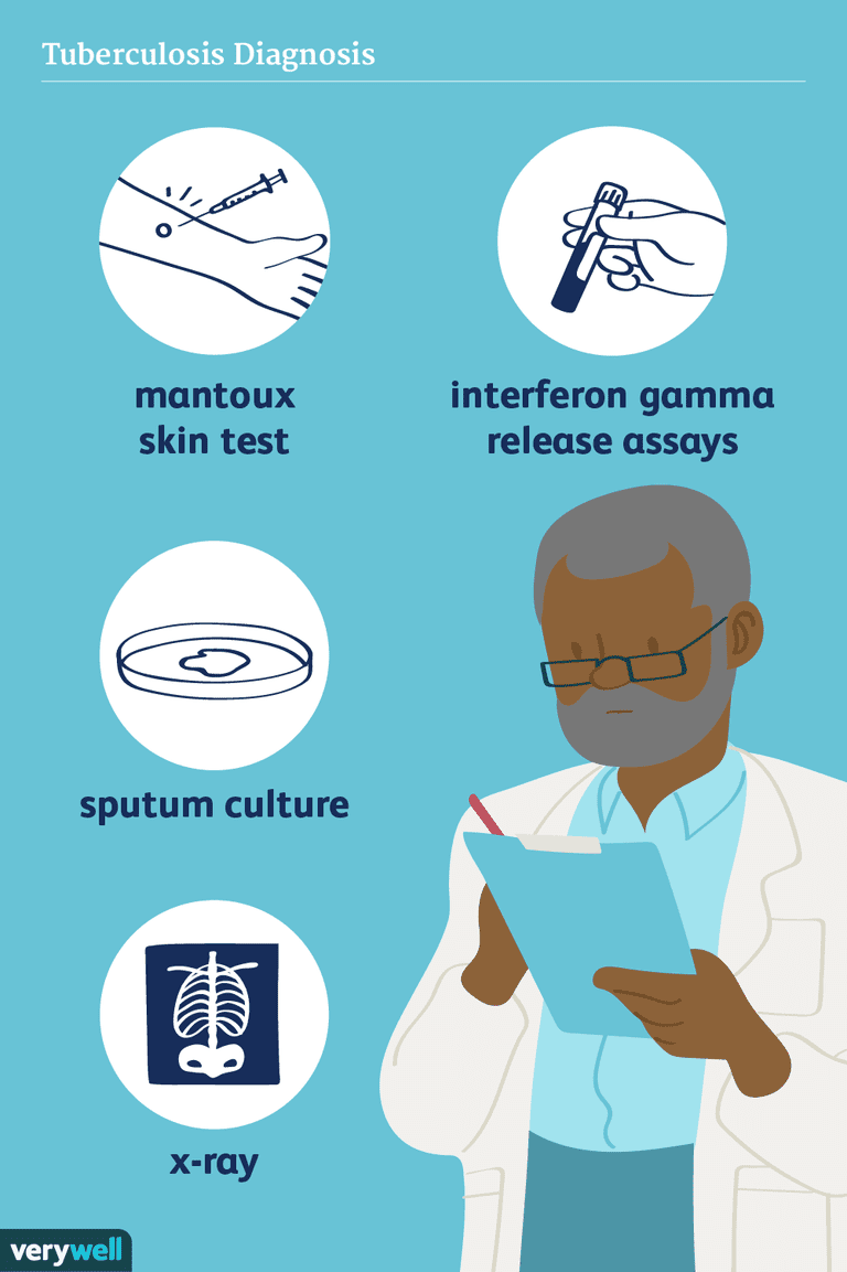 mycobacterium-tuberculosis-lab-diagnosis-stain-vs-culture-vs-pcr