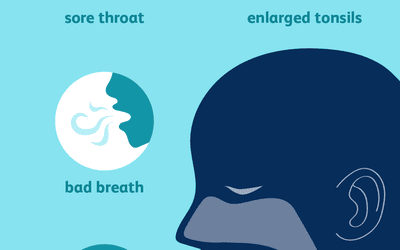 Tonsillectomy Risks vs. Benefits: Is It Worth It?