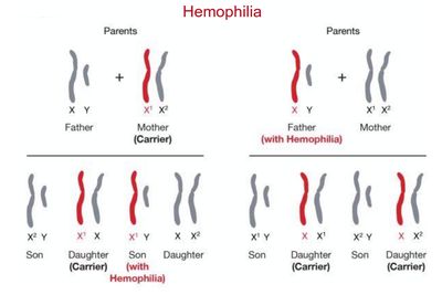 Sex Chromosome Abnormalities