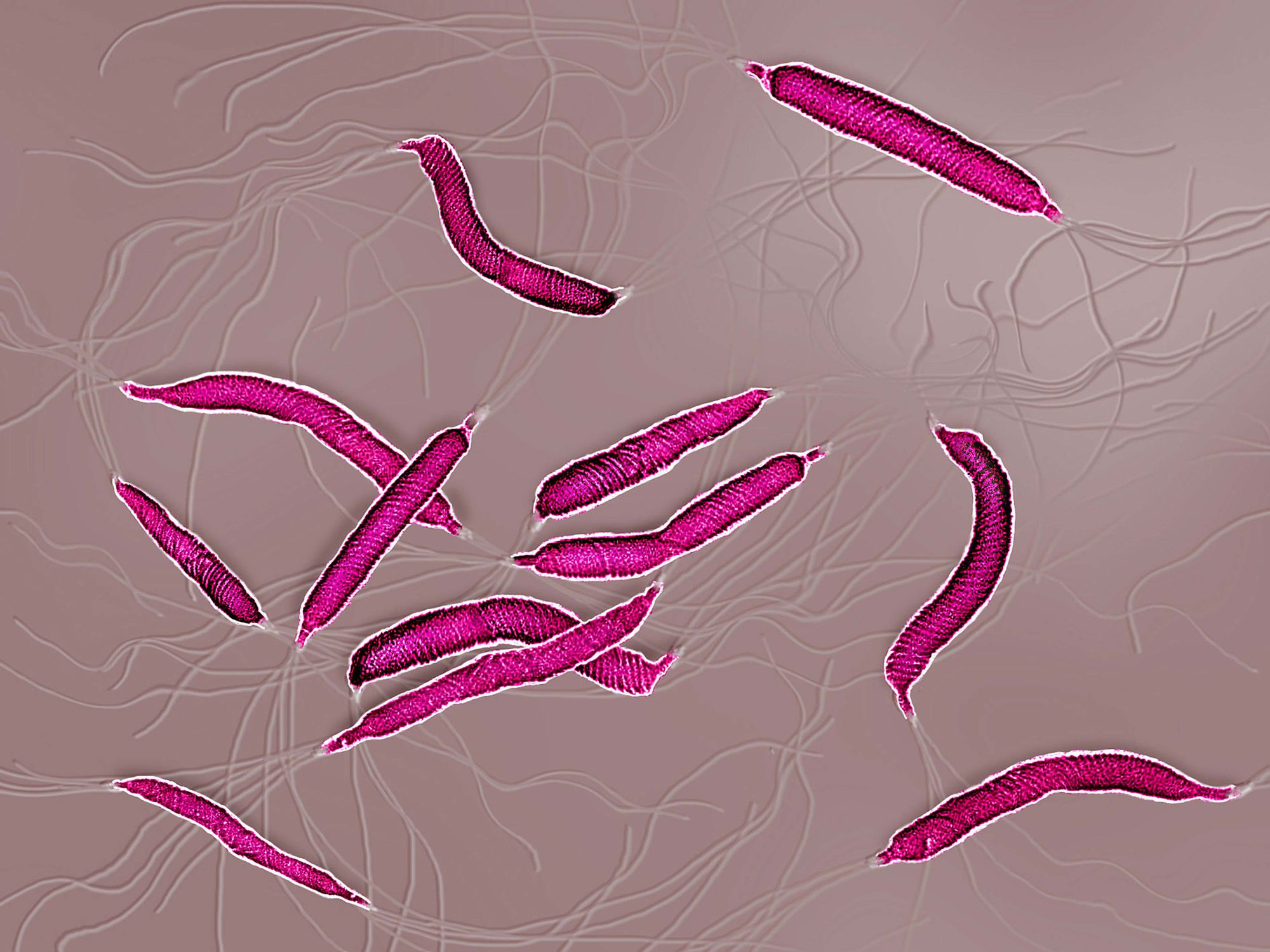 Helicobacter Pylori Infection and Migraines