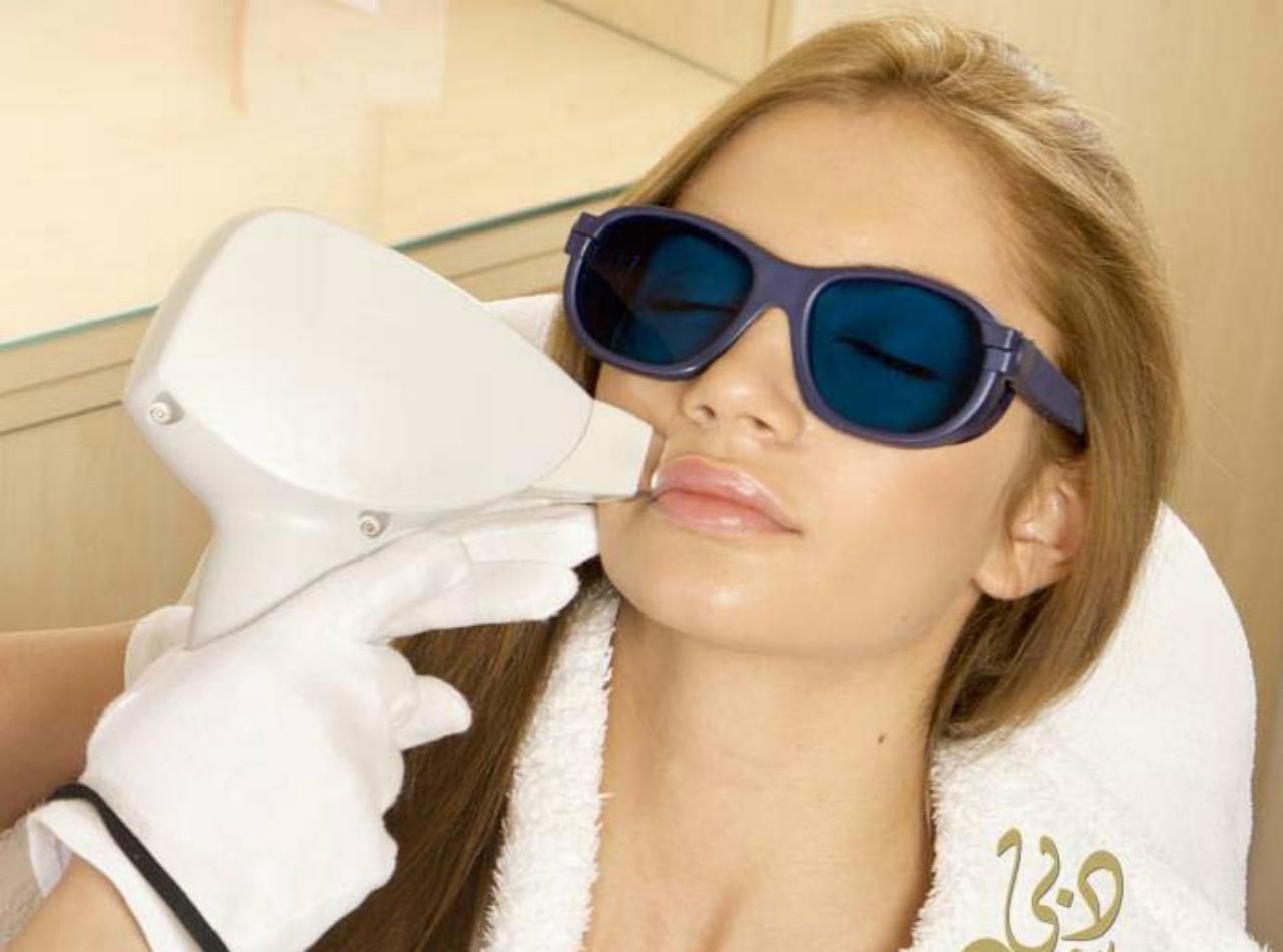 Electrolysis or Laser for Upper Lip Hair Removal?