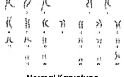 How Is a Karyotype Test Done?