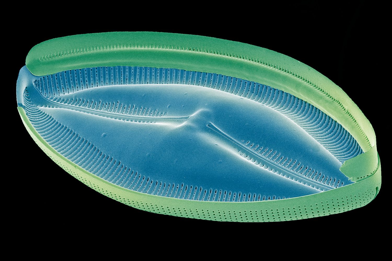 protista-kingdom-characteristics-types-and-examples