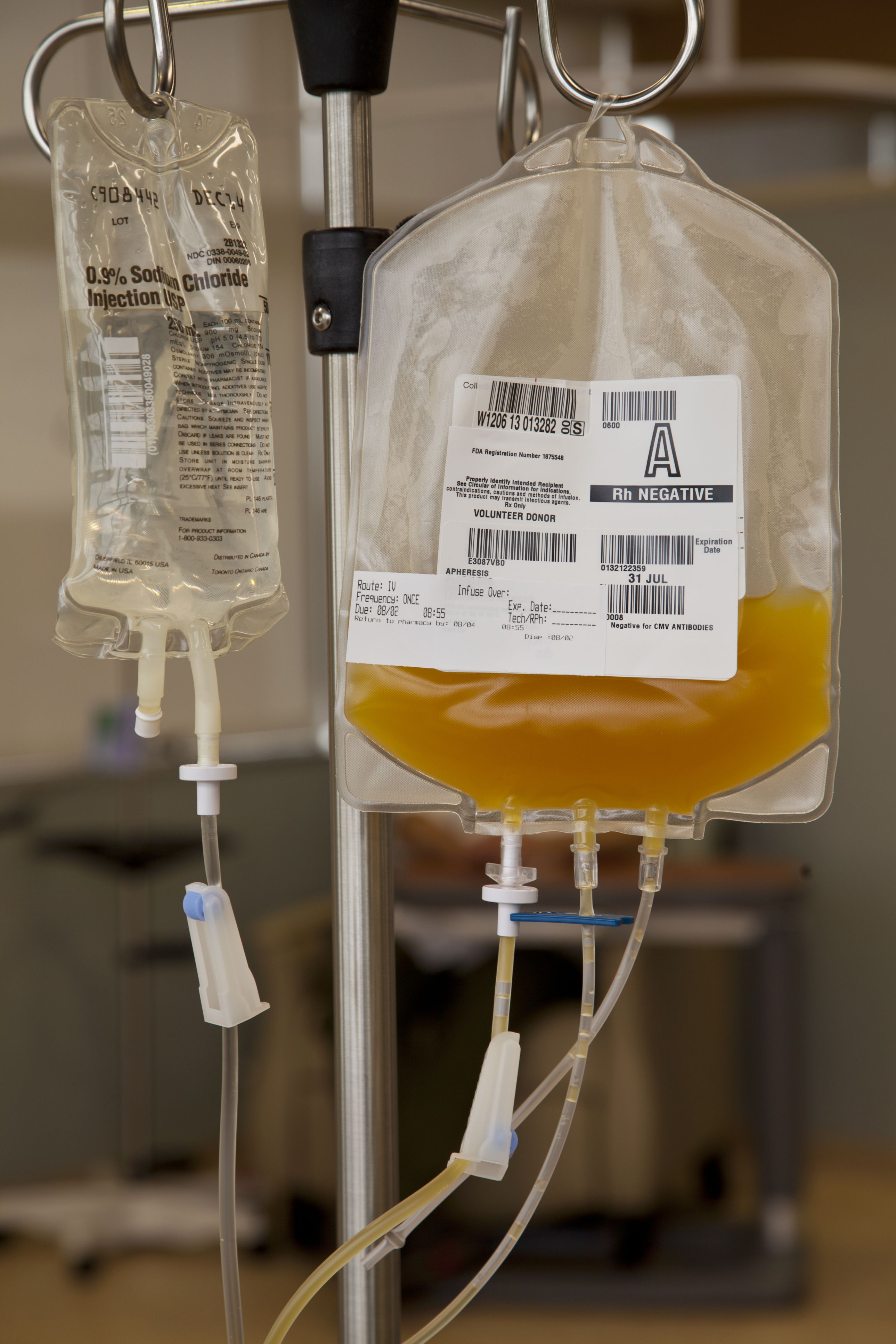 thrombocytopenia-a-tale-of-low-platelet-counts