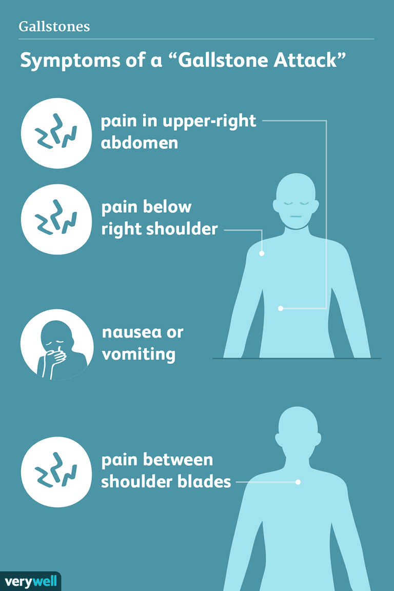 gall-stone-symptoms-bloating