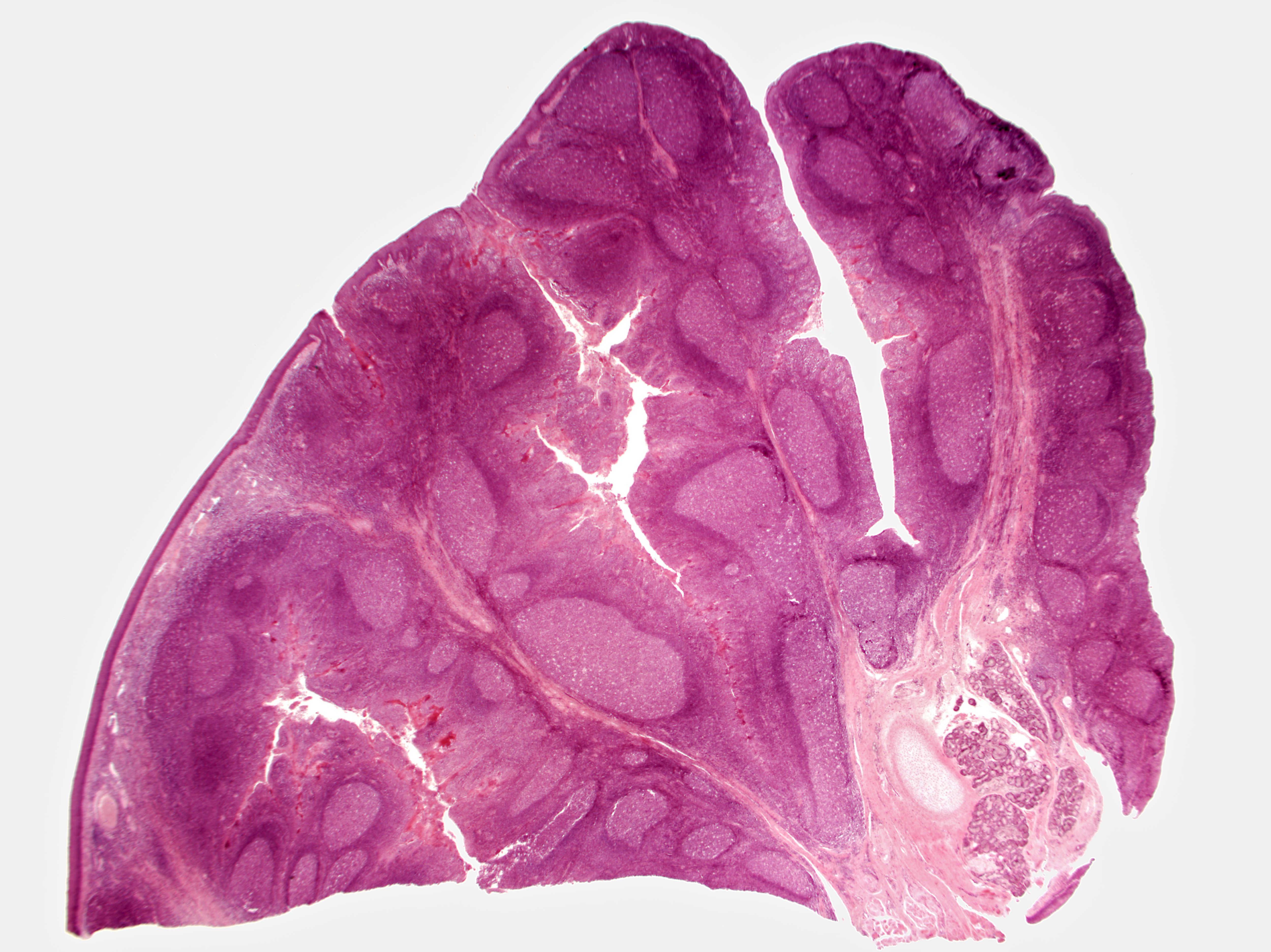 what-to-do-about-cryptic-tonsils