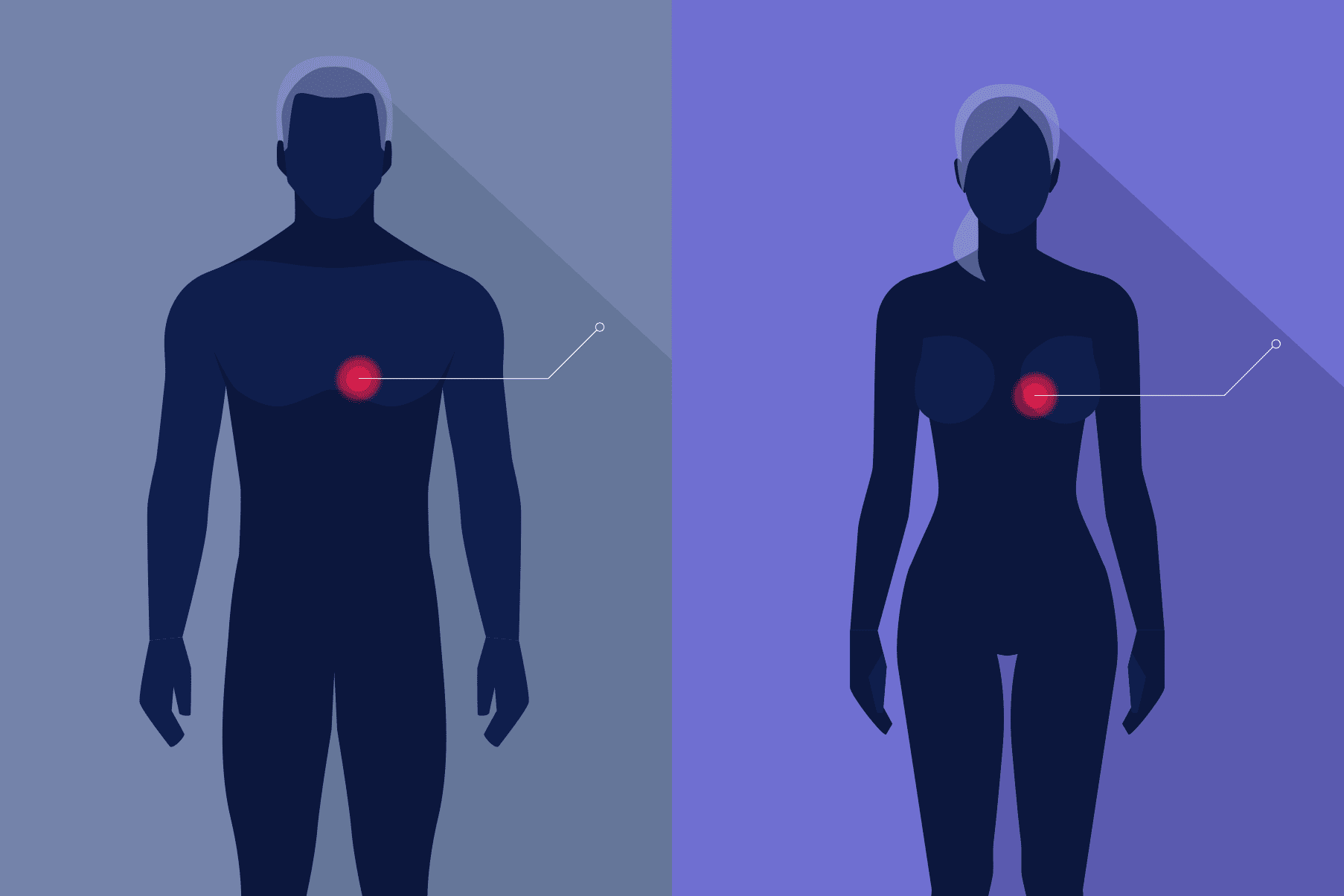 Heart Disease: Men vs. Women