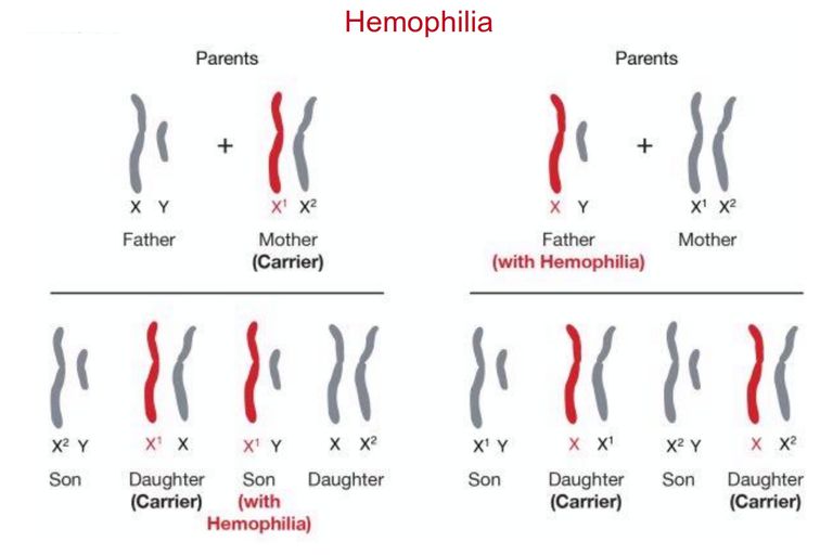 Learn About Sex Linked Traits And Disorders 