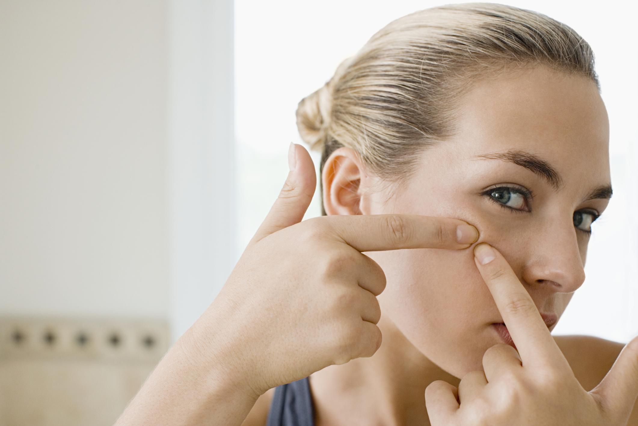 Is Popping Pimples Bad For Your Skin 