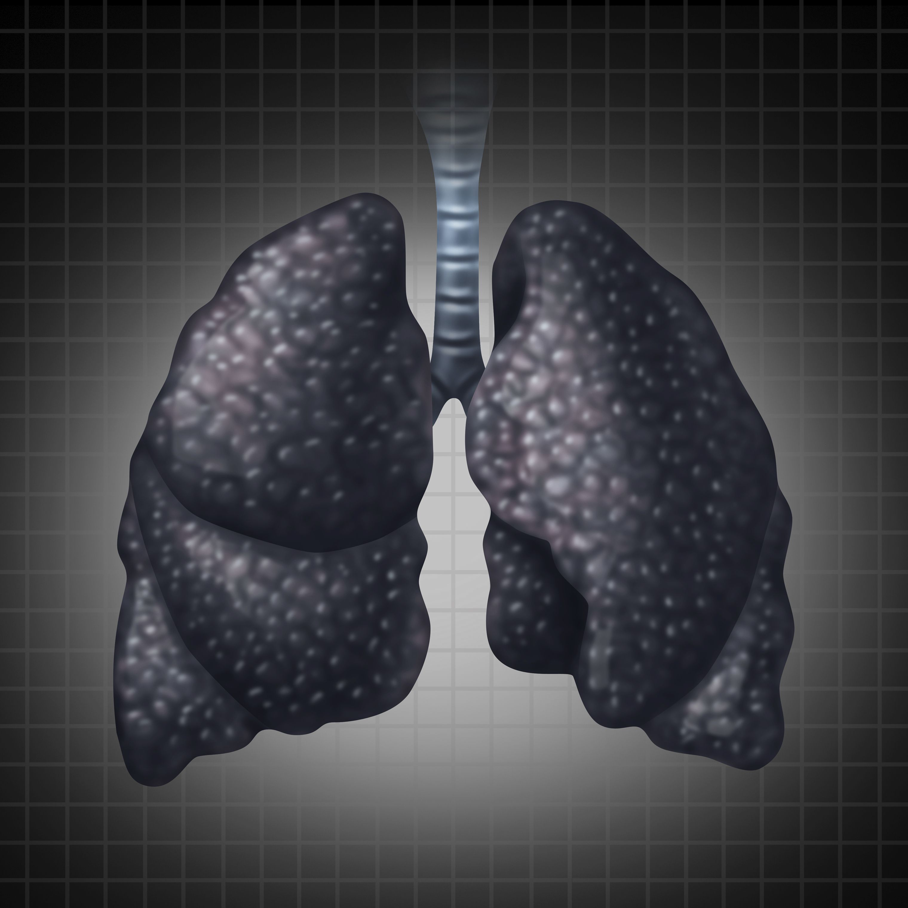 what-are-the-leading-causes-of-lung-cancer