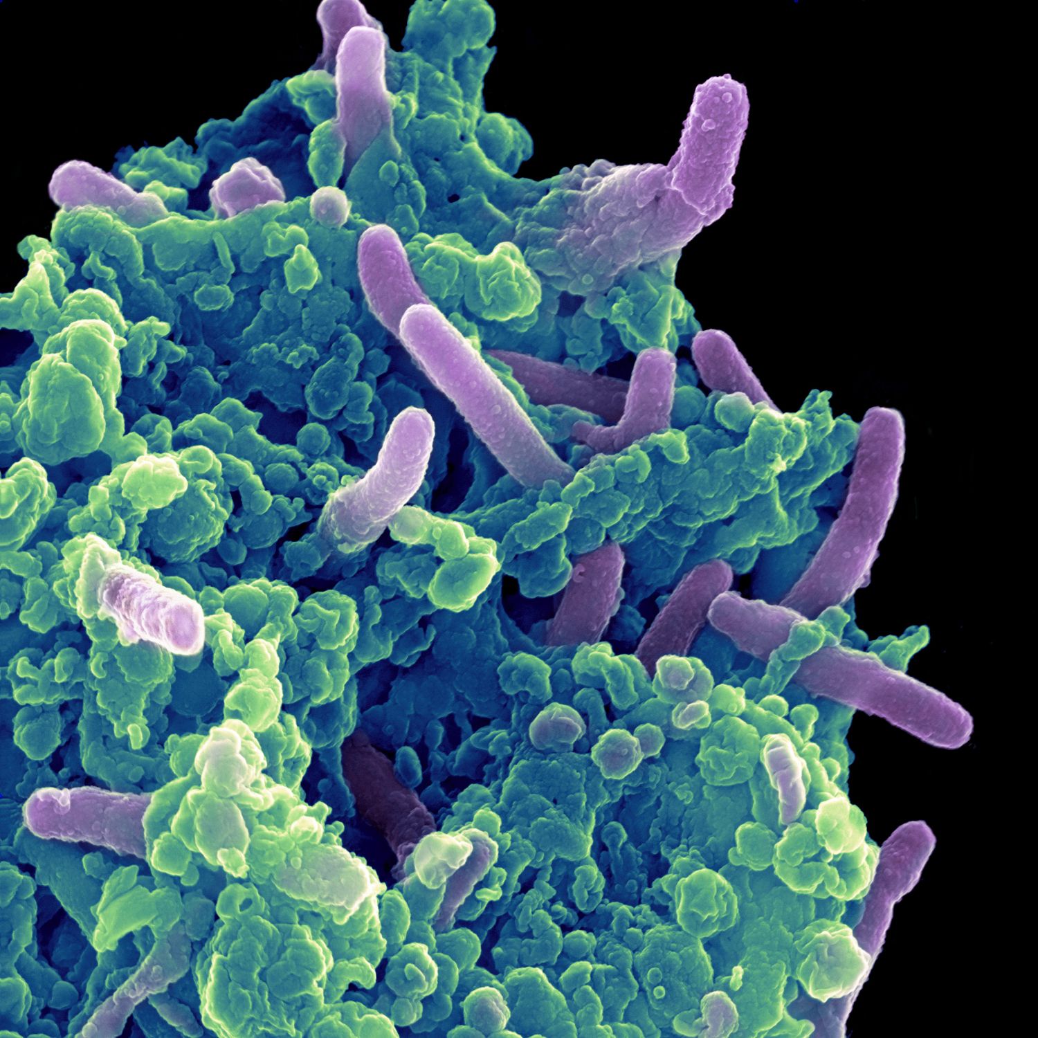 8-types-of-white-blood-cells