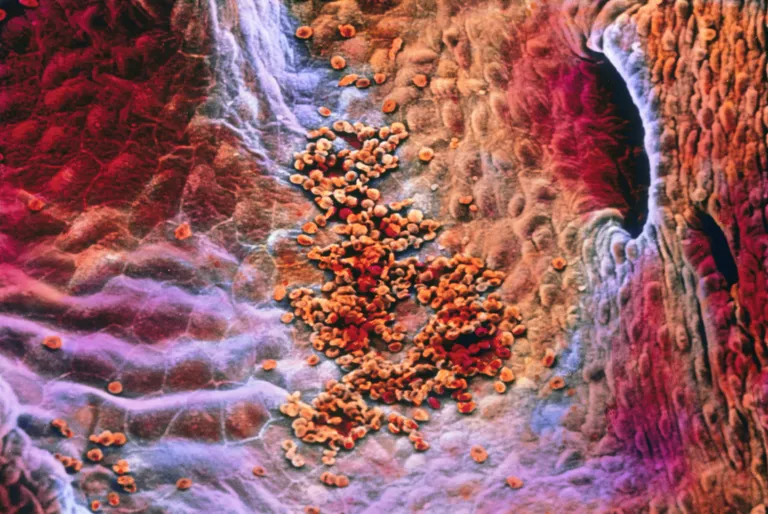 Endocardium