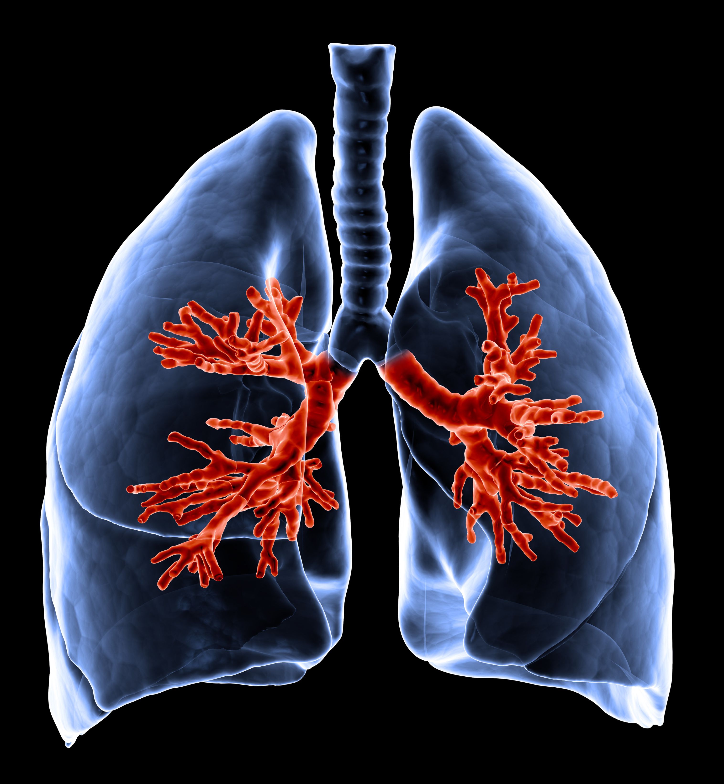 WHO Classification of Pulmonary Hypertension