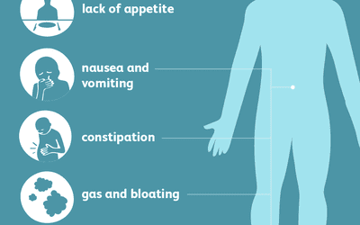 symptoms of diverticulosis