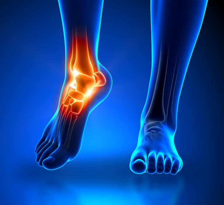 Are Nerve Problems Causing Your Foot Pain?