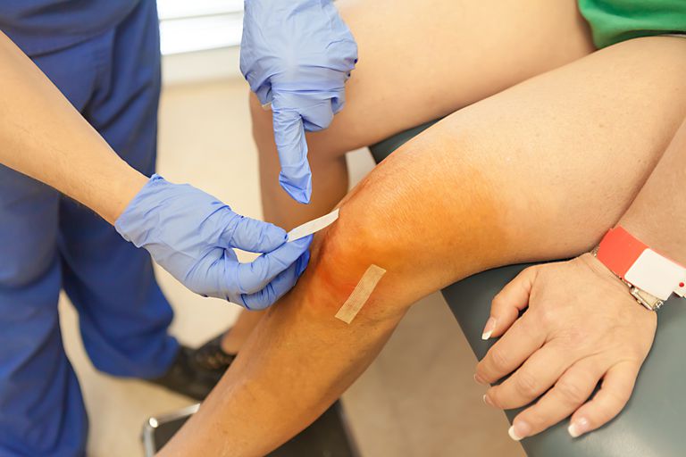 Symptoms Of Infection After Arthroscopic Knee Surgery