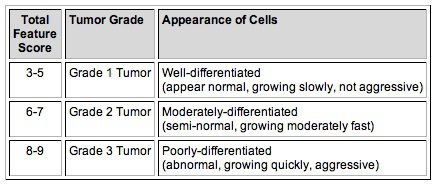 Tumor Grade - Breast Cancer Diagnosis and Treatment