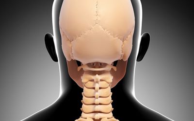 Straight Neck Syndrome Aka Loss Of Cervical Curve