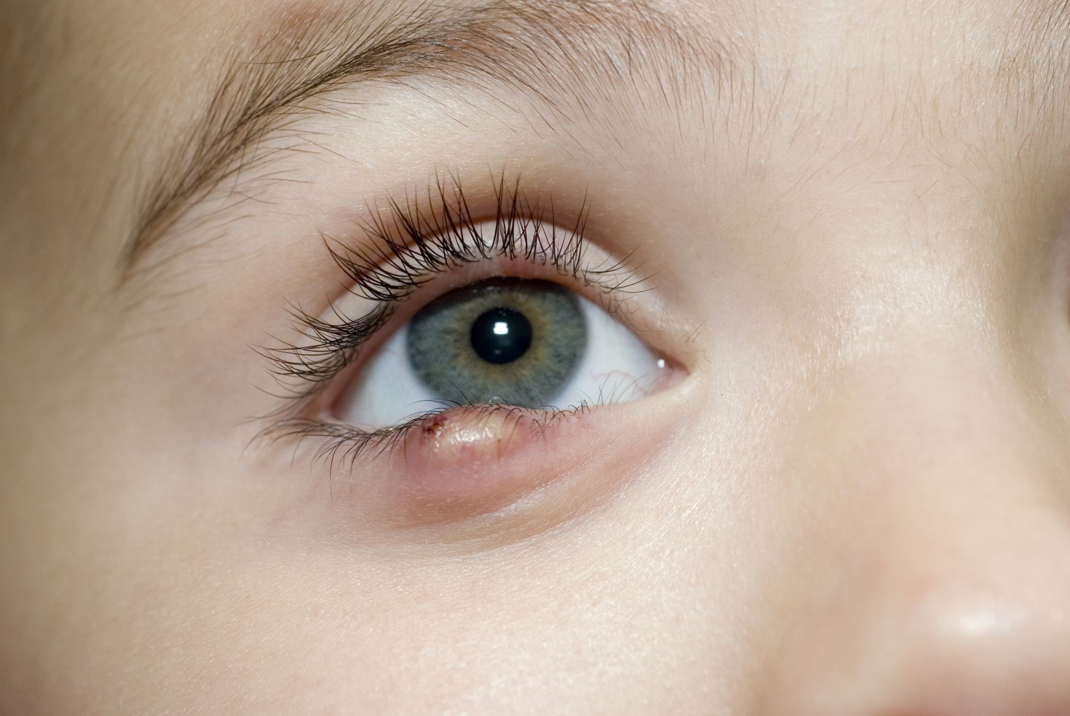 Everything You Need to Know About Baby Eyelid Development