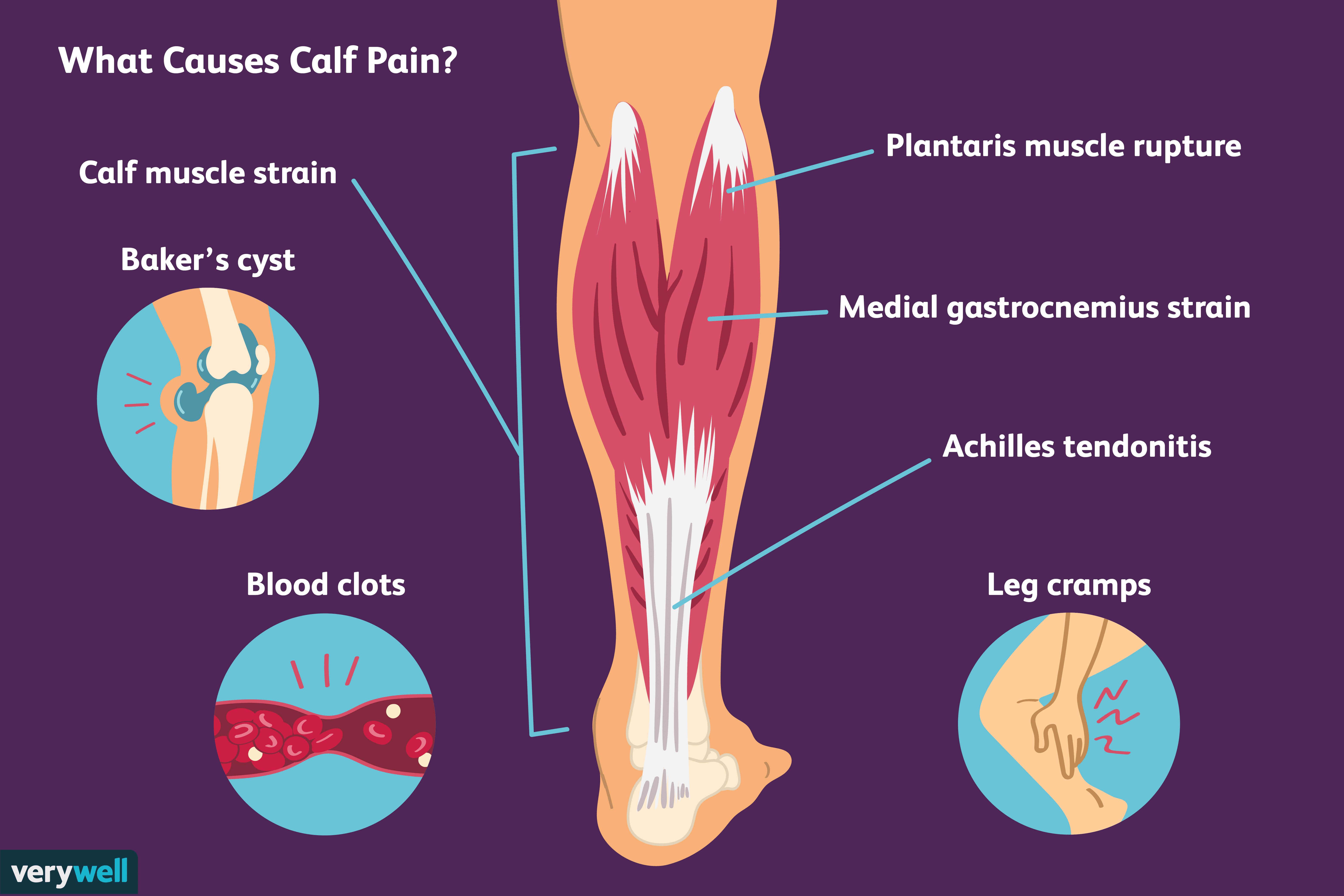 pin-on-what-causes-pain-behind-the-knee-pain-behind-knee-aza-food-for