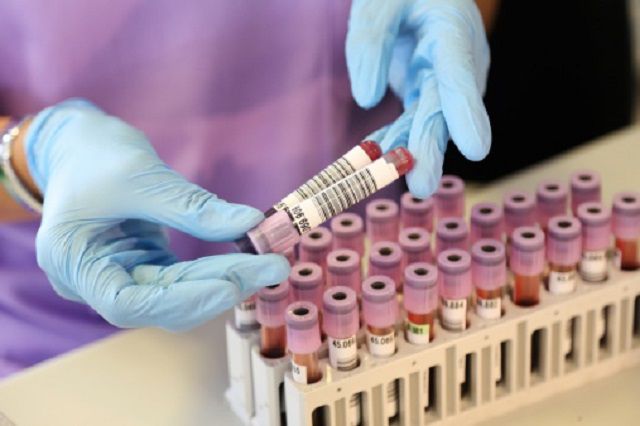 heart types test Lab Mean on Your Volume Platelet Results (MPV)